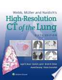 Webb M Ller And Naidich S High Resolution Ct Of The Lung