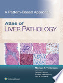 Atlas Of Liver Pathology A Pattern Based Approach