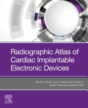 Read Pdf Radiographic Atlas of Cardiac Implantable Electronic Devices - E-Book