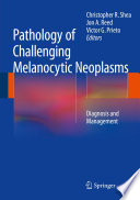 Pathology Of Challenging Melanocytic Neoplasms