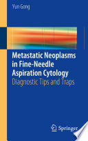 Metastatic Neoplasms In Fine Needle Aspiration Cytology