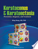 Keratoconus Keratoectasia