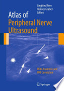 Atlas Of Peripheral Nerve Ultrasound