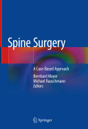 Read Pdf Spine Surgery