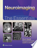 Neuroimaging The Essentials