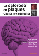 Read Pdf La sclérose en plaques - Clinique et thérapeutique