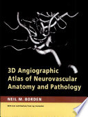 3d Angiographic Atlas Of Neurovascular Anatomy And Pathology