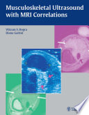 Musculoskeletal Ultrasound With Mri Correlations