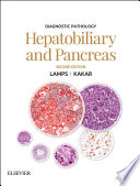Diagnostic Pathology Hepatobiliary And Pancreas E Book