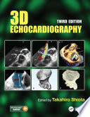 3d Echocardiography