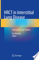 Hrct In Interstitial Lung Disease