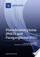 Pheochromocytoma Pheo And Paraganglioma Pgl 