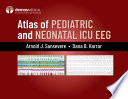 Atlas Of Pediatric And Neonatal Icu Eeg