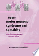 Upper Motor Neurone Syndrome And Spasticity