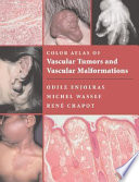 Color Atlas Of Vascular Tumors And Vascular Malformations