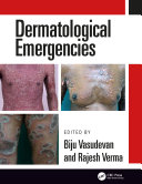 Read Pdf Dermatological Emergencies