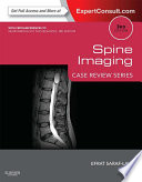 Spine Imaging E Book Book