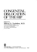 Congenital Dislocation of the Hip