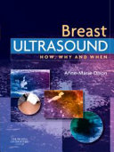 E-Book - Breast Ultrasound