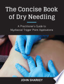 The Concise Book of Dry Needling Book