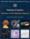 Pathology and Genetics of Tumours of the Digestive System Book