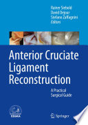 Anterior Cruciate Ligament Reconstruction Book