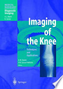 Imaging of the Knee
