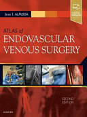 Atlas of Endovascular Venous Surgery Book