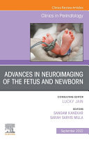 Advances in Neuroimaging of the Fetus and Newborn, An Issue of Clinics in Perinatology, E-Book