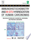 Handbook of Immunohistochemistry and in Situ Hybridization of Human Carcinomas Book