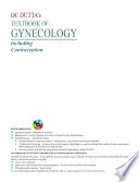 DC Dutta s Textbook of Gynecology Book
