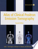 Atlas of Clinical Positron Emission Tomography 2nd Edition Book