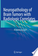 Neuropathology of brain tumors with radiologic correlates /