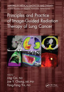 Principles and Practice of Image-Guided Radiation Therapy of Lung Cancer