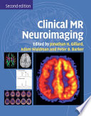 Clinical MR Neuroimaging Book