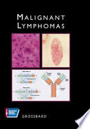 Malignant Lymphomas Book
