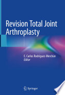 Revision Total Joint Arthroplasty Book
