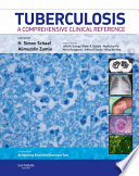 Tuberculosis E Book