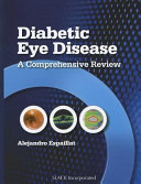 Diabetic Eye Disease Book