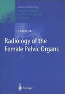 Radiology Of The Female Pelvic Organs