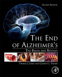 The End Of Alzheimer S