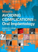 Complications in Oral Implantology Book