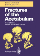 Fractures of the Acetabulum [Pdf/ePub] eBook