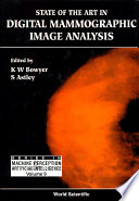 State of the Art in Digital Mammographic Image Analysis Book
