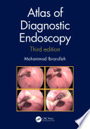 Atlas of Diagnostic Endoscopy  3E Book