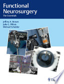 Functional Neurosurgery