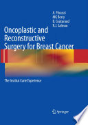 Oncoplastic and Reconstructive Surgery for Breast Cancer Book