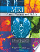 Mri Normal Variants And Pitfalls