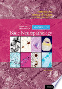 Escourolle and Poirier s Manual of Basic Neuropathology Book