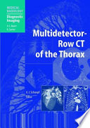 Multidetector Row CT of the Thorax Book